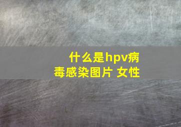 什么是hpv病毒感染图片 女性